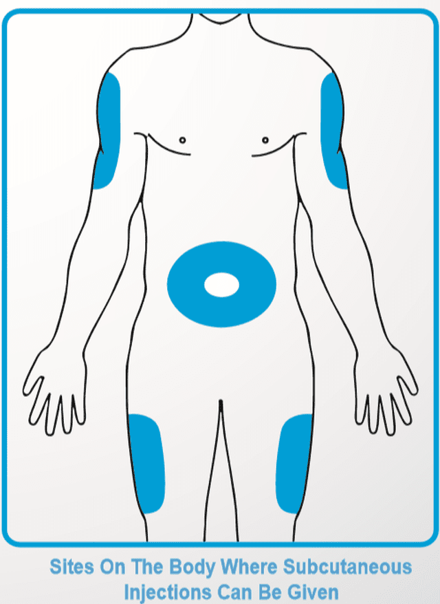 Printable Subcutaneous Injection Site Chart.pdf Subcutaneous Injection – blosmm.com