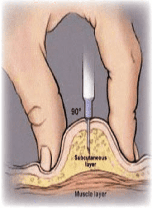 Sc Injection Depth Subcutaneous Injection – blosmm.com